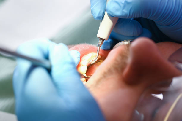 Best Mobile Emergency Dentist in Sebewaing, MI