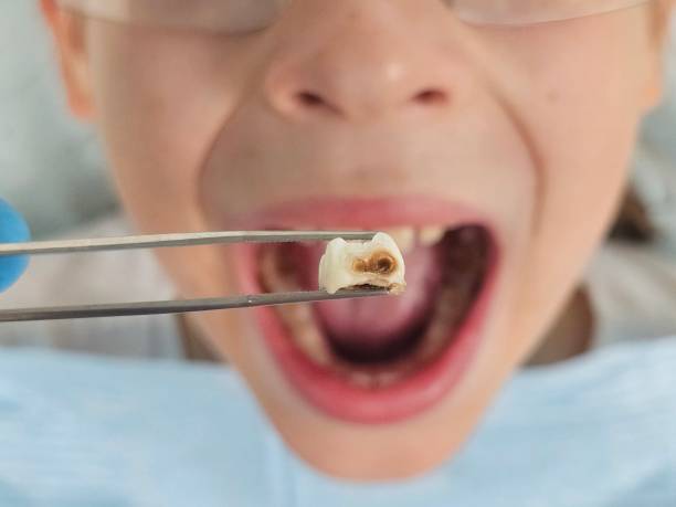 Best Emergency Dentist for Special Needs Patients in Sebewaing, MI