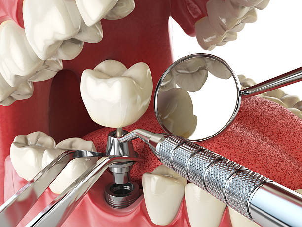 Best Mobile Emergency Dentist in Sebewaing, MI